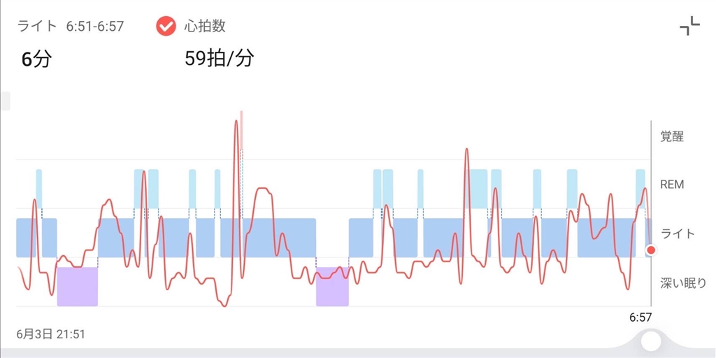 価格.com - 『アプリ上の睡眠分析画面。情報が豊富。』Zepp Health