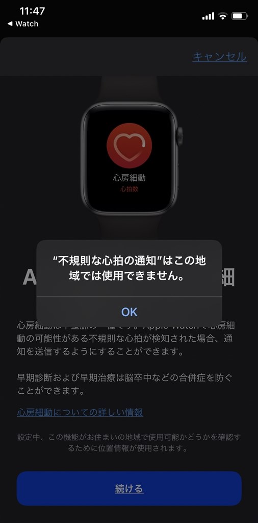 満足:「心電図機能」&「シルバーリンクブレスレット」に交換で 満足:「心電図機能」&「シルバーリンクブレスレット」に交換で