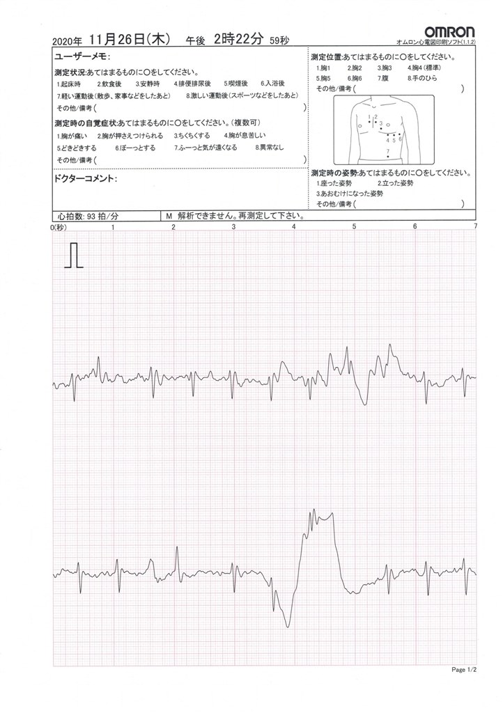 心臓 トリプルチャンバ体外心臓刺激装置 - PACE® 300 - Osypka Medical